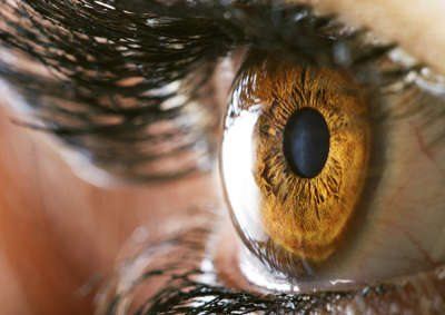 Corneal Transplant, eye surgeon Houston