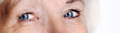 Houston cataract surgeon