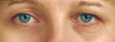 eye specialist Houston